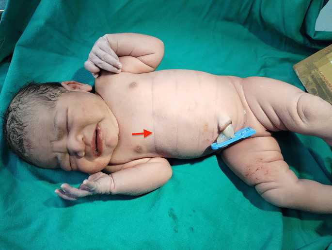 郑州哪个医院人工授精好？附详细第三代代生宝宝包儿子医院排名